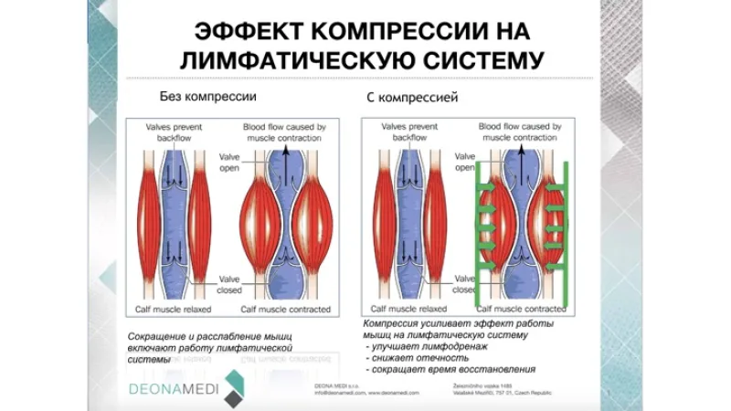 efekt kompresii